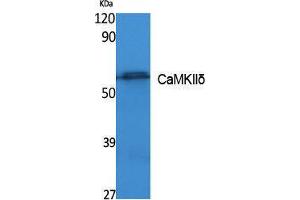 Western Blotting (WB) image for anti-Calcium/calmodulin-Dependent Protein Kinase II delta (CAMK2D) (Internal Region) antibody (ABIN3178095) (CAMK2D 抗体  (Internal Region))
