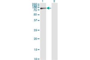Western Blot analysis of FBLN1 expression in transfected 293T cell line by FBLN1 monoclonal antibody (M01), clone 4C9. (Fibulin 1 抗体  (AA 151-250))
