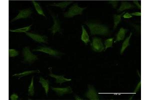 Immunofluorescence of monoclonal antibody to RHOA on HeLa cell. (RHOA 抗体  (AA 1-193))