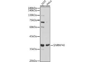 SNRNP40 抗体