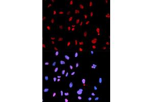 Immunofluorescence analysis of U2OS cells using Phospho-MET-Y1234 antibody (ABIN5969923). (c-MET 抗体  (pTyr1234))