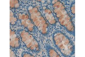 Used in DAB staining on fromalin fixed paraffin- embedded Kidney tissue (DHPS 抗体  (AA 1-369))