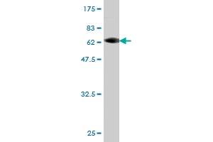 Western Blot detection against Immunogen (62. (CAB39L 抗体  (AA 1-337))