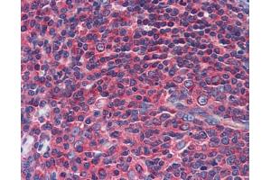 Immunohistochemistry with gut tissue (NPY1R 抗体  (Middle Region))
