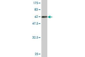 Western Blotting (WB) image for anti-Replication Factor C (Activator 1) 5, 36.5kDa (RFC5) (AA 1-340) antibody (ABIN519753)