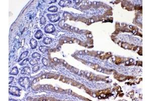 IHC testing of FFPE rat small intestine tissue with UGT1A1 antibody at 1ug/ml. (UGT1A1 抗体)
