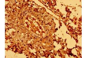 Immunohistochemistry (IHC) image for anti-Sema Domain, Seven Thrombospondin Repeats (Type 1 and Type 1-Like), Transmembrane Domain (TM) and Short Cytoplasmic Domain, (Semaphorin) 5B (SEMA5B) (AA 845-1013) antibody (ABIN7168815)