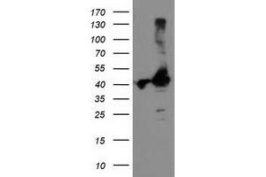 Western Blotting (WB) image for anti-TBC1 Domain Family, Member 21 (TBC1D21) antibody (ABIN1501311) (TBC1D21 抗体)