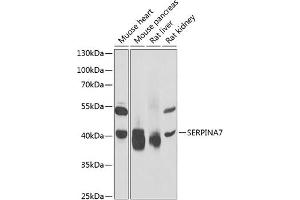 Western blot analysis of extracts of various cell lines, using SERPIN antibody (ABIN6132296, ABIN6147581, ABIN6147582 and ABIN6221920) at 1:1000 dilution. (SERPINA7 抗体  (AA 146-415))