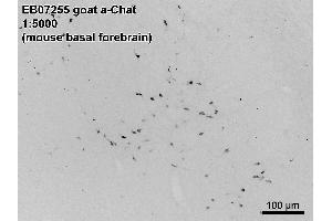 ABIN185635 (0. (Choline Acetyltransferase 抗体  (C-Term))