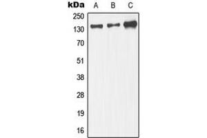 Western blot analysis of JIP3 expression in IMR32 (A), mouse brain.