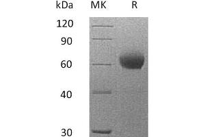 Western Blotting (WB) image for Complement Factor H (CFH) protein (His tag) (ABIN7320842)