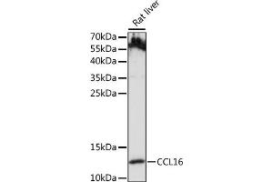 Western blot analysis of extracts of Rat liver, using CCL16 antibody (ABIN7266298) at 1:1000 dilution. (CCL16 抗体  (AA 1-120))