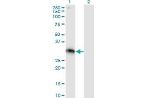 Western Blot analysis of XRCC2 expression in transfected 293T cell line by XRCC2 monoclonal antibody (M01), clone 2H4.