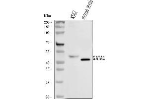 Western blot analysis of GATA1 using anti-GATA1 antibody (ABIN7602077).