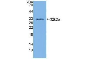 Detection of Recombinant SDH, Human using Polyclonal Antibody to Sorbitol Dehydrogenase (SDH) (SORD 抗体  (AA 98-355))