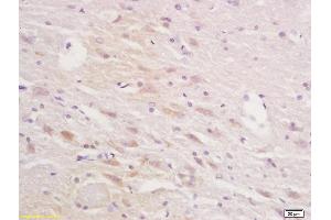 Formalin-fixed and paraffin embedded rat brain tissue labeled with Anti-Squalene EpoxidasePolyclonal Antibody, Unconjugated (ABIN705401) at 1:200 followed by conjugation to the secondary antibody and DAB staining (SQLE 抗体  (AA 101-200))