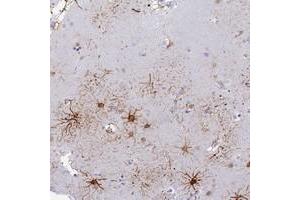 Immunohistochemical staining of human lateral ventricle with ASUN polyclonal antibody  shows distinct positivity in astrocytes and neuropil at 1:200-1:500 dilution. (C12orf11 抗体)