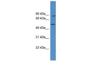 Western Blot showing ZER1 antibody used at a concentration of 1. (ZER1 抗体  (Middle Region))