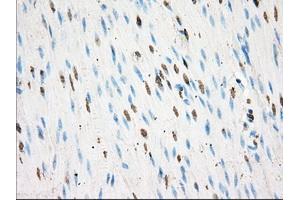 Immunohistochemical staining of paraffin-embedded colon tissue using anti-BSG mouse monoclonal antibody. (CD147 抗体)