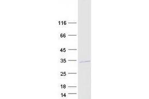 VENTX Protein (Myc-DYKDDDDK Tag)