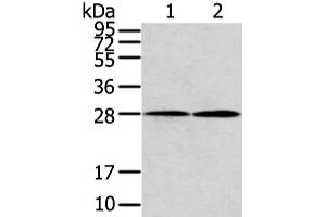 Western Blot analysis of Mouse heart and lung tissue using KCNMB1 Polyclonal Antibody at dilution of 1/500 (KCNMB1 抗体)