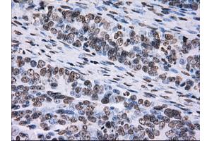Immunohistochemical staining of paraffin-embedded colon tissue using anti-ID3mouse monoclonal antibody. (ID3 抗体)