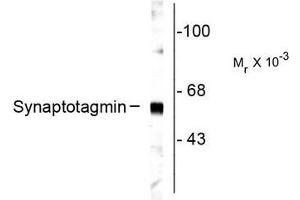 Image no. 1 for anti-Synaptotagmin I (SYT1) antibody (ABIN372723) (SYT1 抗体)