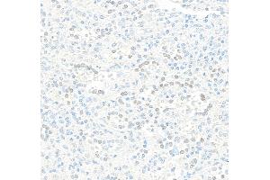 Immunohistochemistry (IHC) image for anti-Jun Dimerization Protein 2 (JDP2) (AA 50-100) antibody (ABIN7795635) (Recombinant JDP2 抗体  (AA 50-100))
