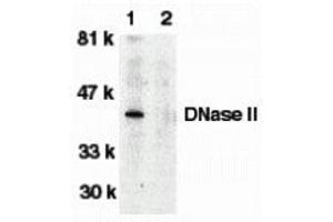Western Blotting (WB) image for anti-Deoxyribonuclease II, Lysosomal (DNASE2) antibody (ABIN1031743) (DNASE2 抗体)