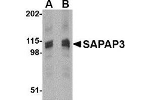 Western Blotting (WB) image for anti-Discs, Large (Drosophila) Homolog-Associated Protein 3 (DLGAP3) (C-Term) antibody (ABIN1030637) (DLGAP3 抗体  (C-Term))