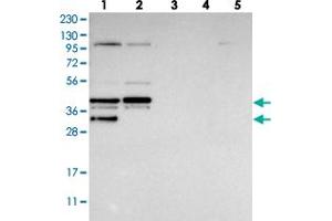 Western blot analysis of Lane 1: RT-4, Lane 2: U-251 MG, Lane 3: Human Plasma, Lane 4: Liver, Lane 5: Tonsil with EBNA1BP2 polyclonal antibody  at 1:250-1:500 dilution. (EBNA1BP2 抗体)