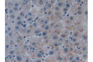 Figure DAB staining on IHC-P Samples: Human Liver Tissue (HMOX1 抗体  (AA 61-172))