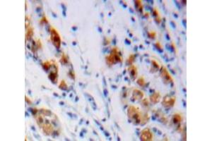 Used in DAB staining on fromalin fixed paraffin-embedded Stomach tissue (LHB 抗体  (AA 23-141))