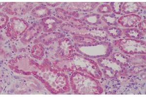 Human Kidney: Formalin-Fixed, Paraffin-Embedded (FFPE) (GSTM1 抗体  (AA 1-159))