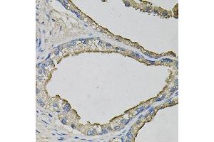 Immunohistochemistry of paraffin-embedded human prostate using LCN1 antibody at dilution of 1:100 (x40 lens).