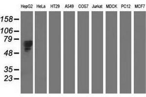 Western blot analysis of extracts (35 µg) from 9 different cell lines by using anti-AFP monoclonal antibody. (alpha Fetoprotein 抗体)