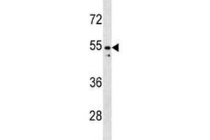 PAX2 antibody western blot analysis in K562 lysate (PAX2A 抗体  (AA 187-216))