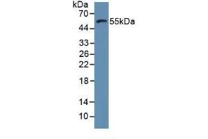 Detection of MMP11 in Human MCF7 Cells using Polyclonal Antibody to Matrix Metalloproteinase 11 (MMP11) (MMP11 抗体  (AA 287-491))