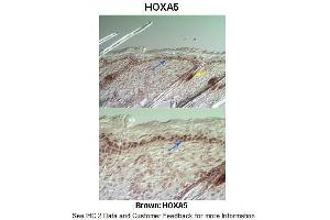 Sample Type :  Mouse dorsal skin -5d postnatal  Primary Antibody Dilution :  1:200  Secondary Antibody :  Anti-rabbit-HRP  Secondary Antibody Dilution :  1:500  Color/Signal Descriptions :  Brown: HOXA5  Gene Name :  HOXA5  Submitted by :  Alexander Awgulewitsch, Ph. (HOXA5 抗体  (Middle Region))