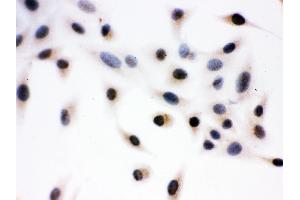 Anti- DAXX Picoband antibody,ICC ICC: A549 Cell