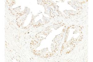 Immunohistochemistry (IHC) image for anti-Bromodomain Containing 4 (BRD4) (AA 1312-1362) antibody (ABIN7453424) (BRD4 抗体  (AA 1312-1362))