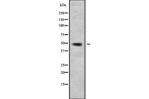 Western blot analysis of CLP1 using LOVO whole cell lysates
