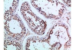 Immunohistochemical analysis of paraffin-embedded Human-testis, antibody was diluted at 1:100. (PIK3R2 抗体  (AA 1-60))