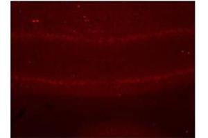 Immunohistochemistry with cerebellum tissue (SGCE 抗体  (N-Term))