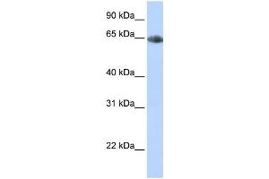 Western Blotting (WB) image for anti-Solute Carrier Family 6 (Neurotransmitter Transporter, Noradrenalin), Member 2 (SLC6A2) antibody (ABIN2458614) (SLC6A2 抗体)