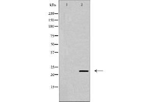 Western blot analysis of CLDN6 expression in Jurkat cells,The lane on the left is treated with the antigen-specific peptide. (Claudin 6 抗体  (Internal Region))