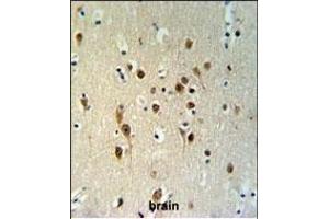 Immunohistochemistry (Paraffin-embedded Sections) (IHC (p)) image for anti-TOX High Mobility Group Box Family Member 3 (TOX3) (AA 214-242) antibody (ABIN651009)