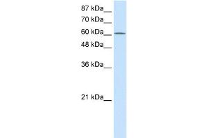 WB Suggested Anti-PRMT5 Antibody Titration:  2. (PRMT5 抗体  (N-Term))