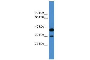OTUB2 antibody used at 0. (OTUB2 抗体  (Middle Region))